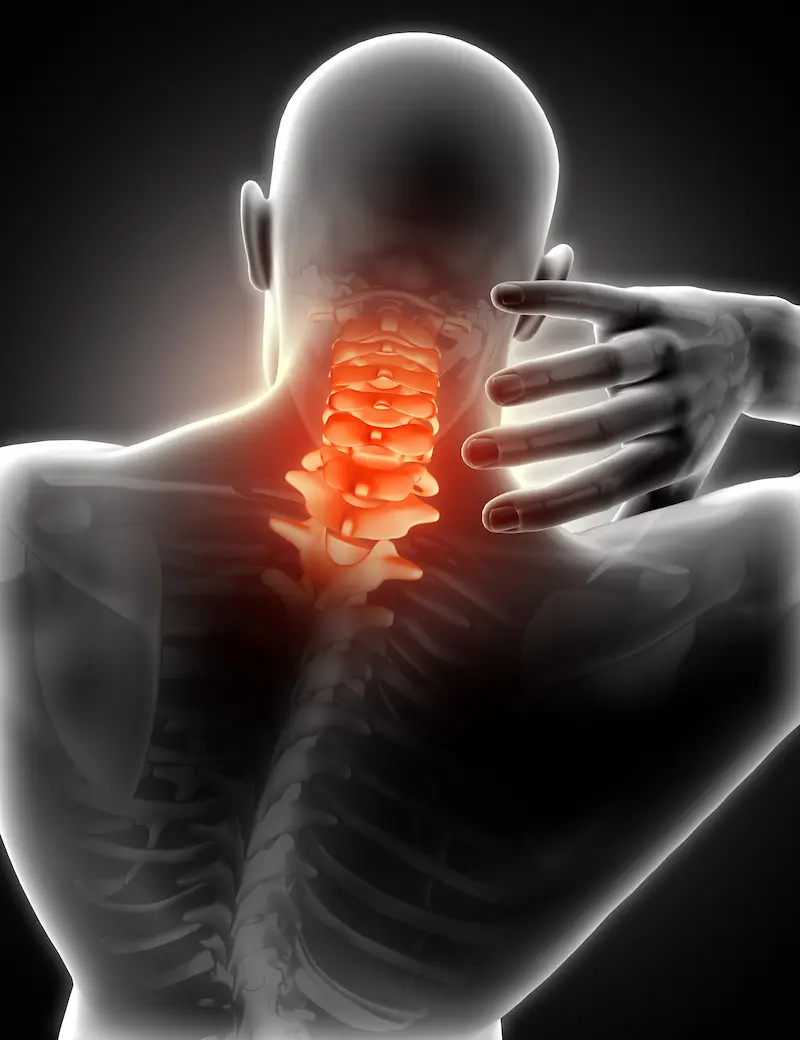Dolor cervical